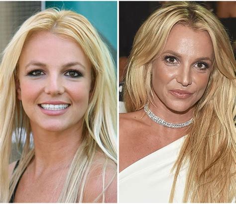 Did Britney Spears Get Plastic Surgery Over The。